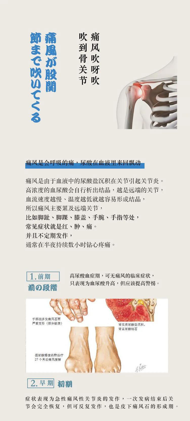痛风，痛不欲生